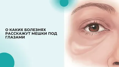 Синяки и отеки под глазами: что делать? Читай в блоге FACEBAR