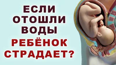 Тест для определения подтекания околоплодных вод Frautest amnio -  «Поберегите свои нервы и семейный бюджет, а при подозрениях - лучше  обращаться к врачу!» | отзывы