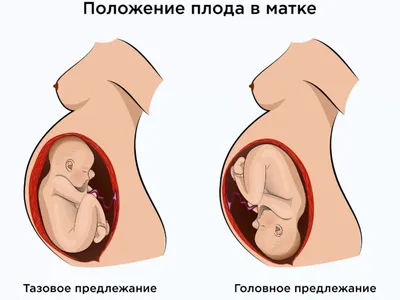 Когда у меня на 22 неделе отошли воды, врачи посоветовали аборт\": как  сегодня выглядят близнецы, которые не должны были выжить | ПИПЛ | Дзен