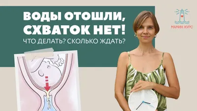 Воды отошли, а схваток нет - что делать. Прямой эфир с Гагаркиным Романом  Николаевичем - YouTube