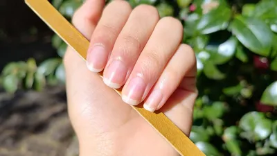 Онихолизис – или что это за странные пятна на ногтях? Онихоли́зис — это отслоение  ногтя от ногтевого ложа. Визуально проявляет себя в виде области белёсого  или жёлтого оттенка. Отделение ногтевой пластины от