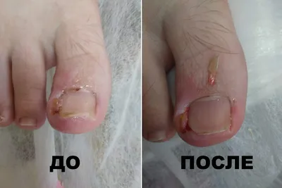 Лечение ногтей СПб. Лечение болезней ногтей в Nail Clinic
