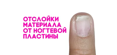 vera_nails_semey - Отслойки😬твёрдого геля 1️⃣Что будет если их оставить?  2️⃣Как их правильно убирать? 3️⃣Почему они бывают ? -Ох уж эти отслойки !  Говорит мастер снимая старый материал 😏 -Пока их снимешь столько