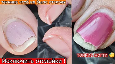 По каким причинам происходит отслоение покрытия гель-лаком | Купить все для  маникюра в Минске. Все для ногтей в Интернет-магазине гель-лаков