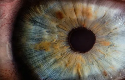 Клиника Здоровье - Сетчатка глаза: заболевания и их лечение