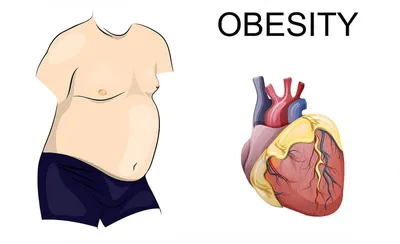 Справа сердце человека с ожирением а слева здорового. | Пикабу