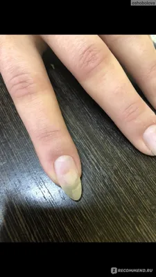 Разбираемся: вредит ли гель-лак ногтевой пластине? - pro.bhub.com.ua