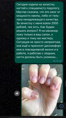 _nails_natali_zp_ - ОЖОГИ НОГТЕЙ😢 Есть 2 вида ожогов 🔥ХИМИЧЕСКИЙ ОЖОГ  из-за гель-лаковых баз и акригелей которые имеют всвоём составе высокий  процент метакриловой кислоты. Она накапливается в ногтевой пластине и  разрушает её. Вызывает