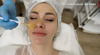 Энзимный пилинг для лица в Москве заказать по цене от 7000 руб. Face Clinic