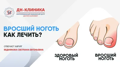 Можно вылечить паховую грыжу без операции