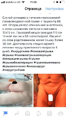 Лечение паховой грыжи в Одессе в медицинском доме Odrex | Медицинский дом  Odrex