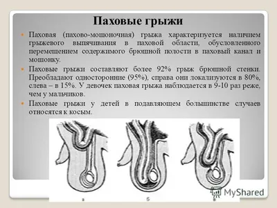 ▷Можно ли ребенку с грыжей живота заниматься спортом? ✓ ADONIS