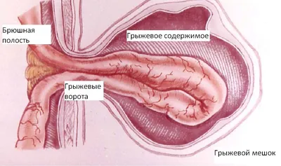 Анатомия: Паховый канал, canalis inguinalis.