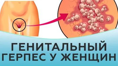 Лишай у человека | симптомы, причины и лечение