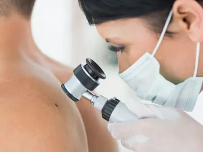 Лечение рака кожи в Германии в ведущих клиниках страны