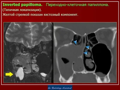 9 фактов о ВПЧ, которые должна знать каждая женщина | DoctorAISt Врач  гинеколог-эндокринолог Анна Игоревна Стельмашенко | Дзен