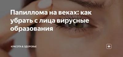 🥇 Удаление папиллом, бородавок и кондилом лазером по выгодной цене в  Алматы | MLC