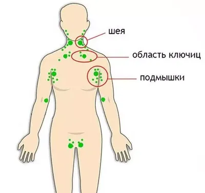 Папилломавирусная инфекция - лечение вируса папиллому у женщин и мужчин в  Новосибирске