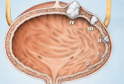 Акция на лазерное сужение влагалища | Damas Medical Center