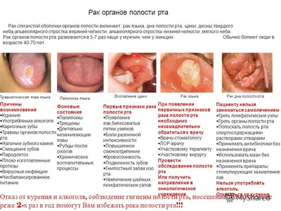 Доброкачественные новообразования полости рта. | Врач-онколог Чачух Азамат  Заурович | Дзен