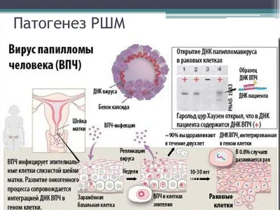 Папиллома: как передается вирус ВПЧ, насколько он опасен и можно ли  заразиться в общественном месте