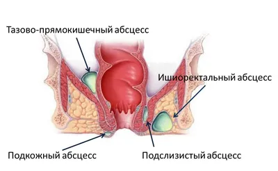 Бывает ли геморрой у собак: симптомы, лечение в домашних условиях и у  врача, профилактика