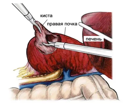 КТ пазух носа в Краснодаре - цены, отзывы, показания, как происходит  исследование | Клиника «УРО-ПРО»