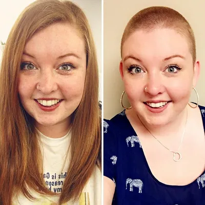 Люди жертвуют волосы на парики для онкобольных: 30 снимков до и после