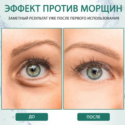 Christytb: E_katerina: Гиалуроновые патчи для кожи вокруг глаз Thalgo  Hyaluronic Eye-patch Mask