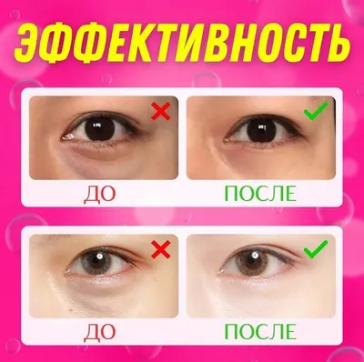 Dari cosmetics Патчи гидрогелевые для кожи вокруг глаз