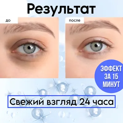Купить Антивозрастные гелевые патчи для области вокруг глаз Lifting Liquid  Eye Patches Skinphoria на официальном сайте по лучшей цене