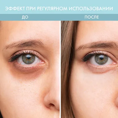 Zozu Eye Mask Shea Crystal Repair Smooth - Гидрогелевые патчи под глаза с  экстрактом авокадо и маслом Ши: купить по лучшей цене в Украине | Makeup.ua