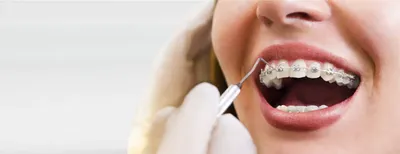 Исправление прикуса зубов в стоматологии в Москве, цены