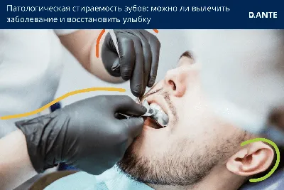 Исправление глубокого прикуса в Омске, цены на выравнивание зубов в  стоматологии «Ортодонт-центр»
