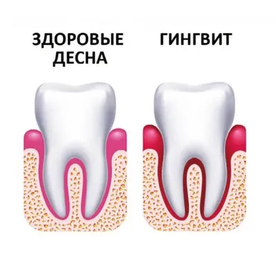 ПВХ анатомическая патология, модель зубов, медицинская Анатомия  человеческого рта и зубов, обучение человеческим зубам | AliExpress