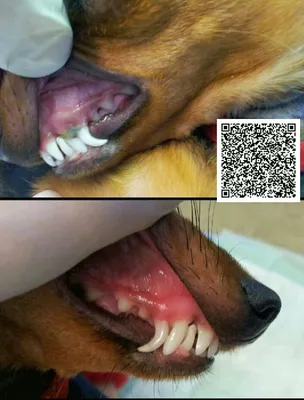 Лечение тортоаномалии зубов в ортодонтическом центре Студия Улыбки
