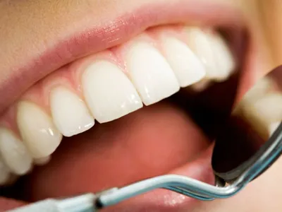 Пример сложного ортодотического лечения после травиатического удаления зубов  и патологического перелома н жней челюсти | Instagram