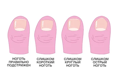 Какой модный педикюр 2024 сделать: красивый педикюр модные тенденции