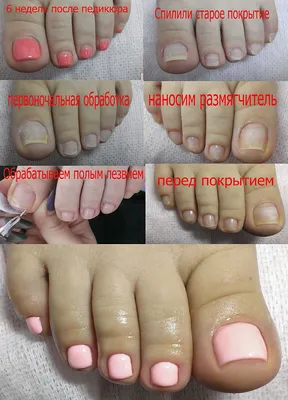 Педикюр эстетика | Toe nails, Gel toe nails, Simple toe nails