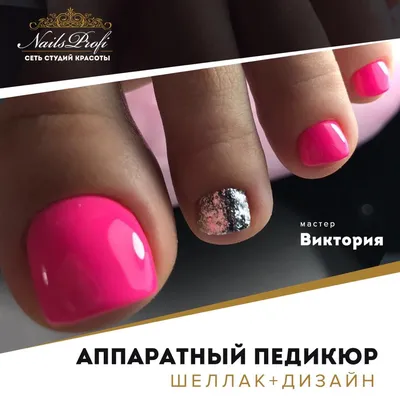 Аппаратный педикюр шеллак + дизайн - Студия красоты \"NailsProfi\"