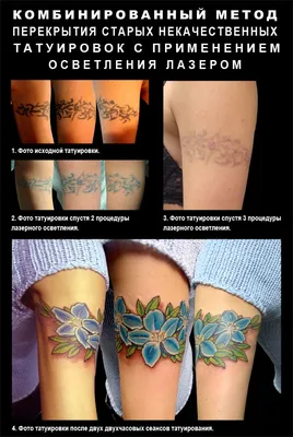 Фото - Перекрытие татуировки