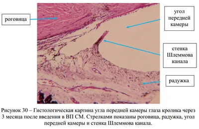 Рисунок 30 – Гистологическая картина угла передней камеры глаза …