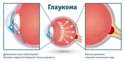 ГЛАЗНАЯ КЛИНИКА | ОПТИКА | ГРОЗНЫЙ on Instagram: \"Кратко о строении глаза👁  ⠀ Глаза - сложная система, основная задача которой передать изображение  через зрительный нерв в мозг для дальнейшей обработки. ⠀ Как