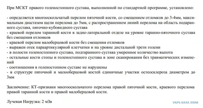 Перелом лодыжки | Фото до и после, операция, отзывы, лечение, реабилитация  и восстановление