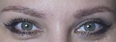 Лазер выжег волосы»: Мария Погребняк показала себя до и после пересадки  бровей