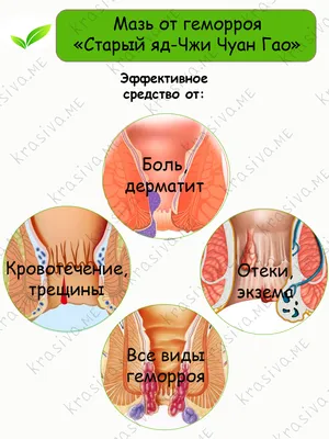 Перианальные фистулы у собак | ВКонтакте