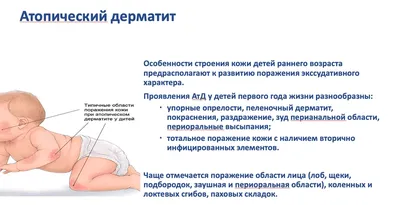 Про перианальный стрептококковый дерматит (ПСД). Это инфекционное  дерматологическое заболевание, которое обычно поражает детей в возрасте… |  Instagram