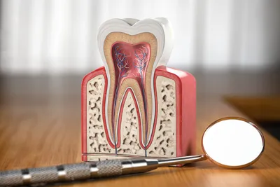 Лечение периодонтита зуба в Королёве - цена в стоматологии Альфа-Дент