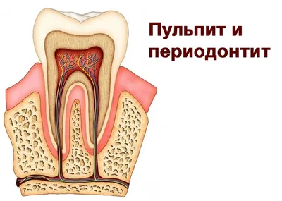 Лечение периодонтита в СПб - цена в стоматологии \"Чистое дыхание\"