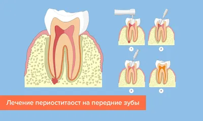 Флюс - причины появления, симптомы заболевания, диагностика и способы  лечения